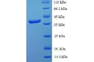 SDS-PAGE (SDS) image for Signal Transducer and Activator of Transcription 3 (Acute-Phase Response Factor) (STAT3) (AA 50-240), (partial) protein (His-SUMO Tag) (ABIN5710422) (STAT3 Protein (AA 50-240, partial) (His-SUMO Tag))