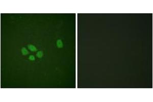 Immunofluorescence analysis of A549 cells, using SOX-9 (Phospho-Ser181) Antibody. (SOX9 Antikörper  (pSer181))