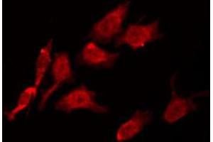 ABIN6274225 staining Hela by IF/ICC. (LTK Antikörper  (Internal Region))