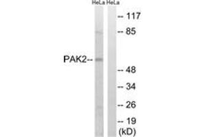 Western blot analysis of extracts from HeLa cells, treated with TSA 400nM 24H, using PAK2 (Ab-141) Antibody. (PAK2 Antikörper  (AA 107-156))