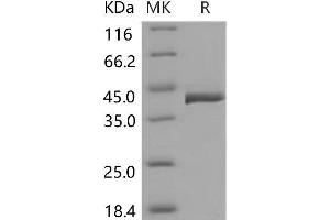 Western Blotting (WB) image for Transcobalamin II (TCN2) protein (His tag) (ABIN7198283) (TCN2 Protein (His tag))