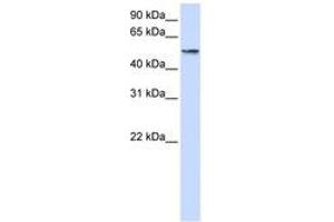 Image no. 1 for anti-Ubiquitin Specific Peptidase 22 (USP22) (AA 216-265) antibody (ABIN6744263) (USP22 Antikörper  (AA 216-265))