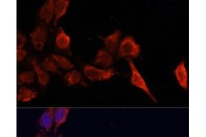 Immunofluorescence analysis of HeLa cells using TIMP1 Polyclonal Antibody at dilution of 1:100. (TIMP1 Antikörper)