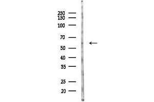 Western blot analysis of lysates from EC304 cells(starvation 24h treatment), using CADM1 Antibody at 1/1000 dilution.