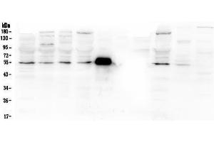 Western blot analysis of MMP13 using anti-MMP13 antibody (ABIN4886667).