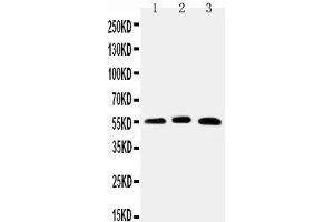 Anti-HNF6 antibody, Western blotting Lane 1: Rat Liver Tissue Lysate Lane 2: Mouse Liver Tissue Lysate Lane 3: HELA Cell Lysate