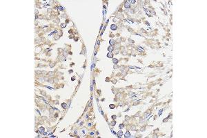 Immunohistochemistry (IHC) image for anti-Williams Beuren Syndrome Chromosome Region 27 (WBSCR27) (AA 1-245) antibody (ABIN7271366)