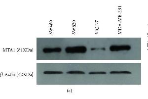 Protein expression of MTA1 by Western Blot analysis. (MTA1 Antikörper  (AA 601-715))