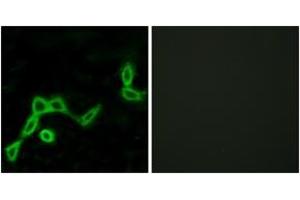 Immunofluorescence analysis of LOVO cells, using KISS1R Antibody. (KISS1R Antikörper  (AA 301-350))
