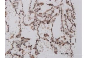 Immunoperoxidase of monoclonal antibody to FOXL1 on formalin-fixed paraffin-embedded human lung. (FOXL1 Antikörper  (AA 132-240))