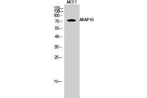 Western Blotting (WB) image for anti-A Kinase (PRKA) Anchor Protein 8 (AKAP8) (Internal Region) antibody (ABIN3173731) (AKAP8 Antikörper  (Internal Region))