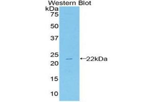 Detection of Recombinant HSPb2, Mouse using Polyclonal Antibody to Heat Shock Protein Beta 2 (HSPb2) (HSPB2 Antikörper  (AA 12-170))