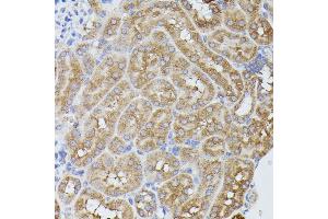 Immunohistochemistry (IHC) image for anti-Protein Phosphatase 2, Regulatory Subunit B', delta (PPP2R5D) (AA 450-550) antibody (ABIN7269690)