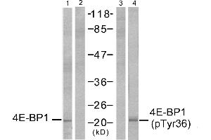 Western blot analysis of extracts from MDA-MB-435 cells, untreated or EGF-treated (200 ng/ml, 30min), using 4E-BP1 (Ab-36) antibody (Line 1 and 2) and 4E-BP1 (phospho-Thr36) antibody (Line 3 and 4). (eIF4EBP1 Antikörper  (pThr36))