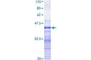 CDKL5 Protein (AA 722-831) (GST tag)