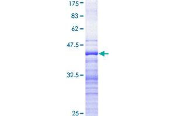 CDKL5 Protein (AA 722-831) (GST tag)