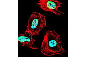 Fluorescent confocal image of Hela cell stained with HDAC1 Antibody (Center ) (ABIN1538397 and ABIN2848543). (HDAC1 Antikörper  (AA 402-430))