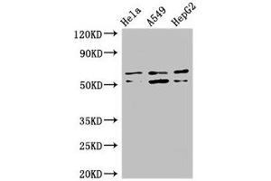 Western Blot Positive WB detected in: Hela whole cell lysate, A549 whole cell lysate, HepG2 whole cell lysate All lanes: COQ8B antibody at 3 μg/mL Secondary Goat polyclonal to rabbit IgG at 1/50000 dilution Predicted band size: 61, 56 kDa Observed band size: 61, 56 kDa (COQ8B Antikörper  (AA 10-137))