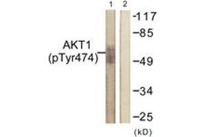 Western blot analysis of extracts from COS7 cells treated with UV 15', using Akt (Phospho-Tyr474) Antibody.