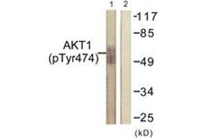 Western blot analysis of extracts from COS7 cells treated with UV 15', using Akt (Phospho-Tyr474) Antibody. (AKT1 Antikörper  (pTyr474))