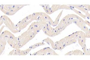 Immunohistochemistry (IHC) image for anti-Dihydrolipoyl Transacetylase (DLAT) (AA 368-626) antibody (ABIN7432412)