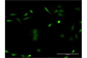 Immunofluorescence of monoclonal antibody to CSNK1E on HeLa cell.