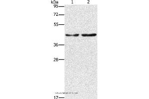 Western blot analysis of Hela and 293T cell, using CBX6 Polyclonal Antibody at dilution of 1:600 (CBX6 Antikörper)
