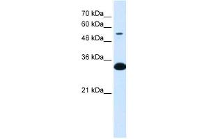 Western Blot showing A1BG antibody used at a concentration of 1-2 ug/ml to detect its target protein. (A1BG Antikörper  (N-Term))