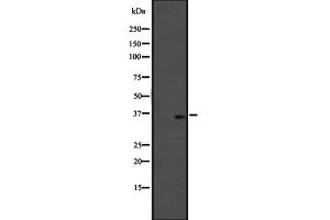 Western blot analysis of OR51M1 expression in SiHa cell line lysates ;,The lane on the left is treated with the antigen-specific peptide. (OR51M1 Antikörper  (C-Term))