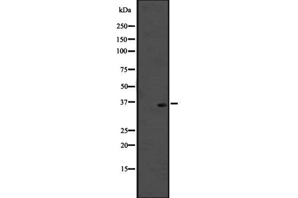OR51M1 antibody  (C-Term)