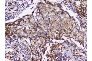 IHC analysis of GRIK1 using anti-GRIK1 antibody (ABIN3042430).