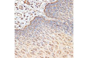 Immunohistochemistry of paraffin-embedded human esophageal using TSC2 Rabbit pAb (ABIN6128542, ABIN6149611, ABIN6149612 and ABIN6213862) at dilution of 1:100 (40x lens). (Tuberin Antikörper  (AA 900-1150))