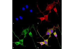 Immunocytochemistry/Immunofluorescence analysis using Mouse Anti-Ataxin 1 Monoclonal Antibody, Clone S76-8 (ABIN1741213). (Ataxin 1 Antikörper  (AA 164-197) (PE))