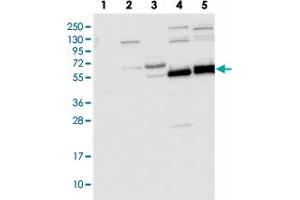 Western blot analysis of Lane 1: RT-4, Lane 2: U-251 MG, Lane 3: Human Plasma, Lane 4: Liver, Lane 5: Tonsil with TRIM7 polyclonal antibody  at 1:250-1:500 dilution. (TRIM7 Antikörper)