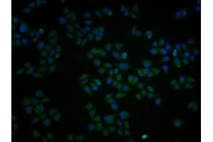 Immunofluorescence staining of Hela cells with ABIN7162877 at 1:100, counter-stained with DAPI. (PCNT Antikörper  (AA 250-600))
