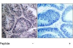 Image no. 1 for anti-conserved Helix-Loop-Helix Ubiquitous Kinase (CHUK) (Thr23) antibody (ABIN197307) (IKK alpha Antikörper  (Thr23))
