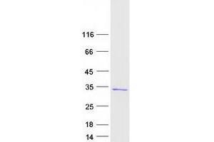 Validation with Western Blot (RAN Protein (Myc-DYKDDDDK Tag))