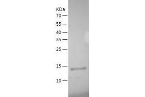 IL-19 Protein (AA 25-176) (His tag)