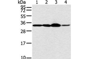 Western blot analysis of Hela and PC3 cell 231 cell and human esophagus cancer tissue using MED6 Polyclonal Antibody at dilution of 1:400 (MED6 Antikörper)