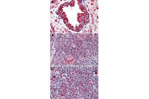 Immunohistochemical staining of formalin-fixed, paraffin-embedded human prostate (A), human thymus (B) and human spleen (C) tissue after heat-induced antigen retrieval. (WNT5B Antikörper  (Internal Region))