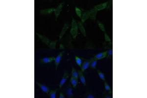 Immunofluorescence analysis of NIH-3T3 cells using ZWINT Polyclonal Antibody (ABIN6128944, ABIN6150552, ABIN6150554 and ABIN6221938) at dilution of 1:100 (40x lens). (ZWINT Antikörper  (AA 1-277))