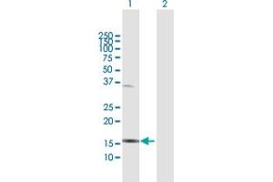 Western Blot analysis of IL1F6 expression in transfected 293T cell line by IL1F6 MaxPab polyclonal antibody.