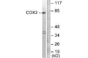 Western blot analysis of extracts from A549 cells, using Cox2 antibody. (COX2 Antikörper)