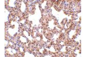 Immunohistochemistry of TRPC6 in mouse lung tissue with TRPC6 polyclonal antibody  at 10 ug/mL .