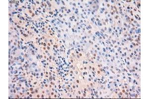 Image no. 8 for anti-Myc Proto-Oncogene protein (MYC) antibody (ABIN1497013) (c-MYC Antikörper)