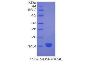 SDS-PAGE (SDS) image for Keratin 2 (KRT2) (AA 7-160) protein (His tag) (ABIN2121481) (Keratin 2 Protein (KRT2) (AA 7-160) (His tag))