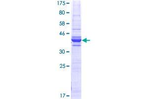 C1QBP Protein (AA 173-282) (GST tag)