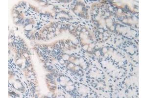 Immunohistochemistry (IHC) image for anti-Gonadotropin-Releasing Hormone 1 (Luteinizing-Releasing Hormone) (GNRH1) (AA 22-90) antibody (ABIN7429916)