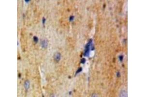 Immunohistochemistry (IHC) image for anti-Lactate Dehydrogenase A (LDHA) (AA 1-332) antibody (ABIN7436900)