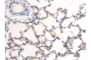 Immunohistochemistry (IHC) image for anti-Aryl Hydrocarbon Receptor Nuclear Translocator-Like (ARNTL) (AA 1-169) antibody (ABIN7435529)